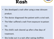 Sentences with Rash, Rash in a Sentence in English, Sentences For Rash